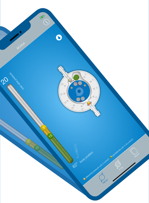 Screenshot der Hydrocephalus App MIETHKE App – durch Kippen des Handys lässt sich die Gravitationstechnologie der MIETHKE Shunts verstehen.